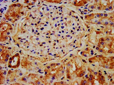 Polyclonal Rabbit anti-Human NAA38 / LSMD1 Antibody