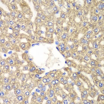 Polyclonal Rabbit anti-Human ALDH2 Antibody (IHC, IF, WB)