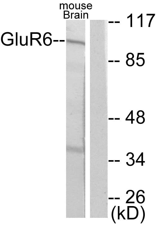 Polyclonal Rabbit anti-Human GRM6 / MGLUR6 Antibody (aa828-877, IHC, WB)