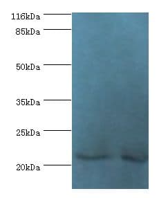 NABP1 / OBFC2A Antibody (aa1-204)