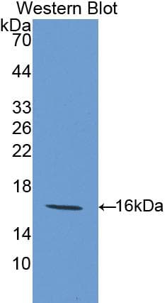 LGALS9 / Galectin 9 Antibody (aa225-353)