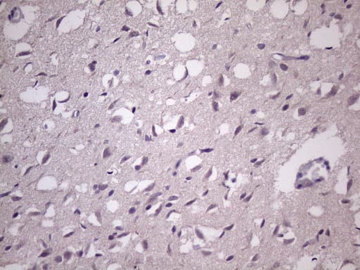 HSF2 Antibody (aa74-324, clone OTI2E11)