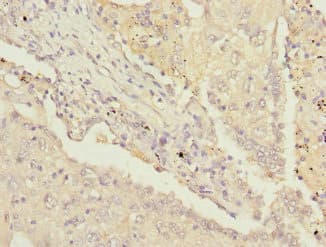 PSMD13 Antibody