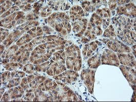 MAP2K1 / MKK1 / MEK1 Antibody (clone OTI1F9)