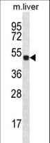 HOXD10 Antibody (aa305-334)