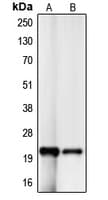 CDKN1A / WAF1 / p21 Antibody (C-Terminus)