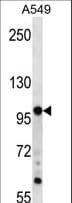 Polyclonal Rabbit anti-Human TPX2 Antibody (aa419-448, WB)