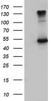 IHC-plus™ Fibulin-3 / EFEMP1 Antibody (clone 1D9)
