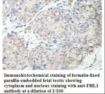 SLIM / FHL1 Antibody (aa18-261)