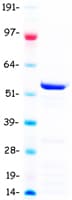 Human TBL1Y / TBL1 Protein (Recombinant Myc-DDK (Flag))