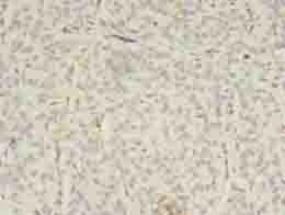 EPHA7 / EPH Receptor A7 Antibody