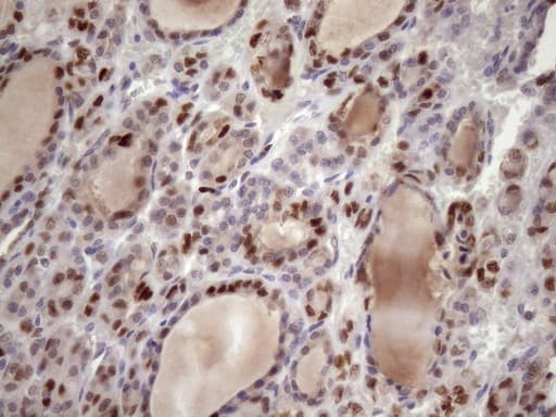 Monoclonal Mouse anti-Human BTEB / KLF9 Antibody (clone OTI8A11, IHC, WB)