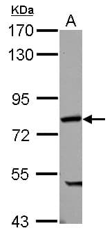Polyclonal Rabbit anti-Human PABPC4 Antibody (IHC, WB)