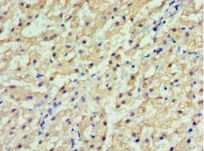 Polyclonal Rabbit anti-Human GSTA2 Antibody (aa1-222, IHC, WB)