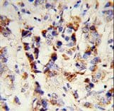 SKIV2L2 Antibody (aa237-263)