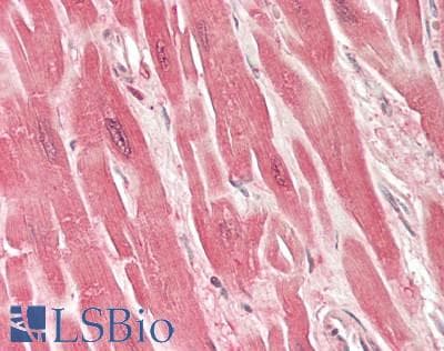 PathPlus™ S100A1 / S100-A1 Antibody (aa 2-94)