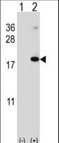 Polyclonal Rabbit anti-Human RMA1 / RNF5 Antibody (aa1-30, WB)