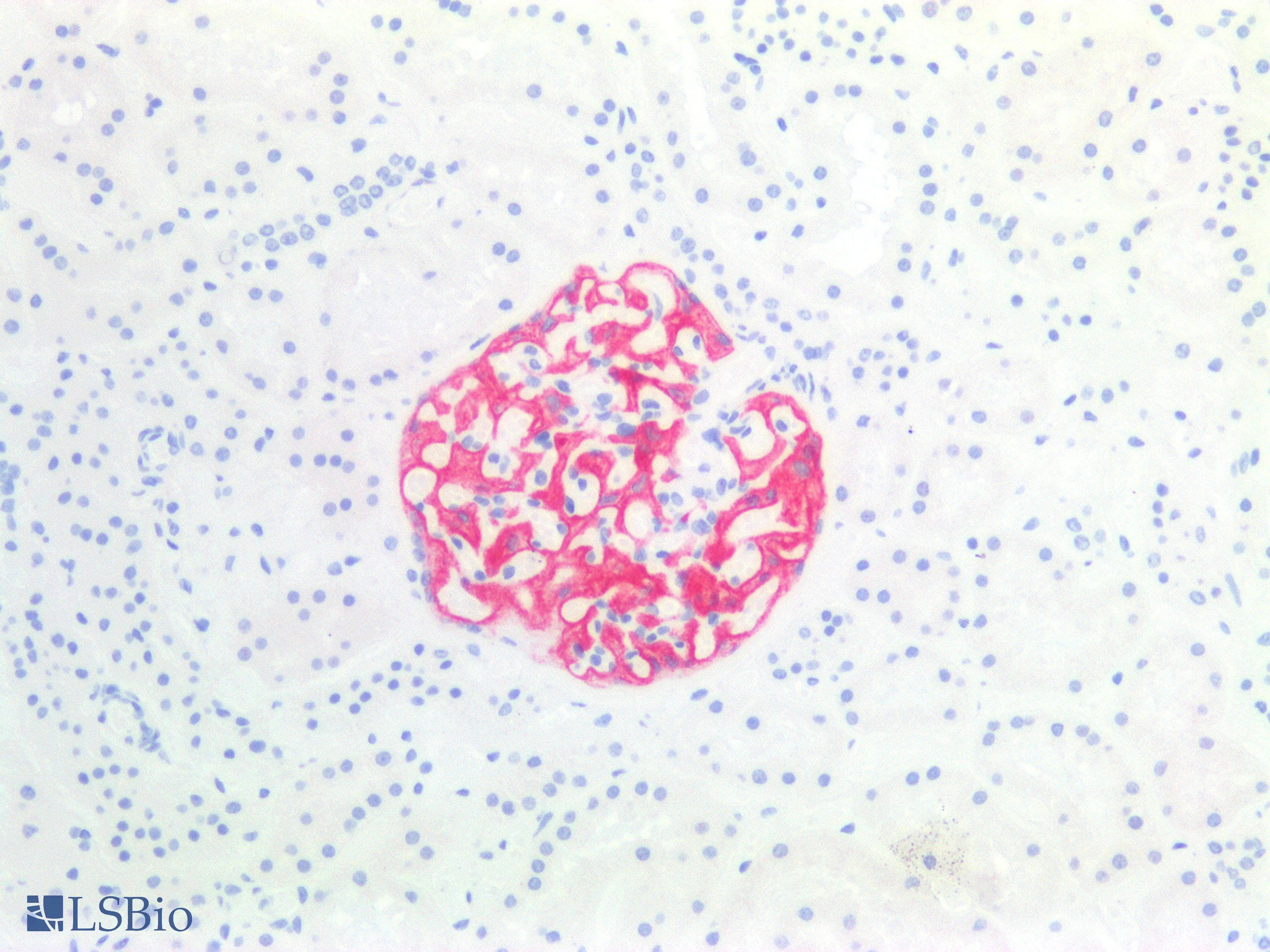 IHC-plus™ F3 / CD142 / Tissue factor Antibody (clone HTF-1)