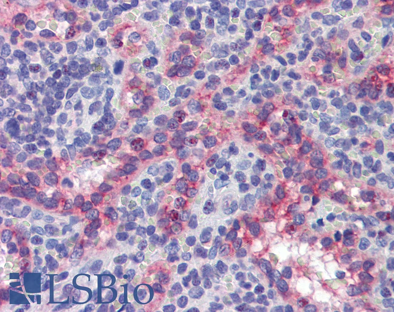 IHC-plus™ Monoclonal Mouse anti-Human NOS3 / eNOS Antibody (clone 6H2, IHC)