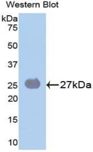 SOCS3 Antibody (aa1-225)