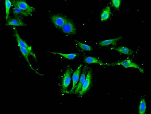 XPO1 / CRM1 Antibody
