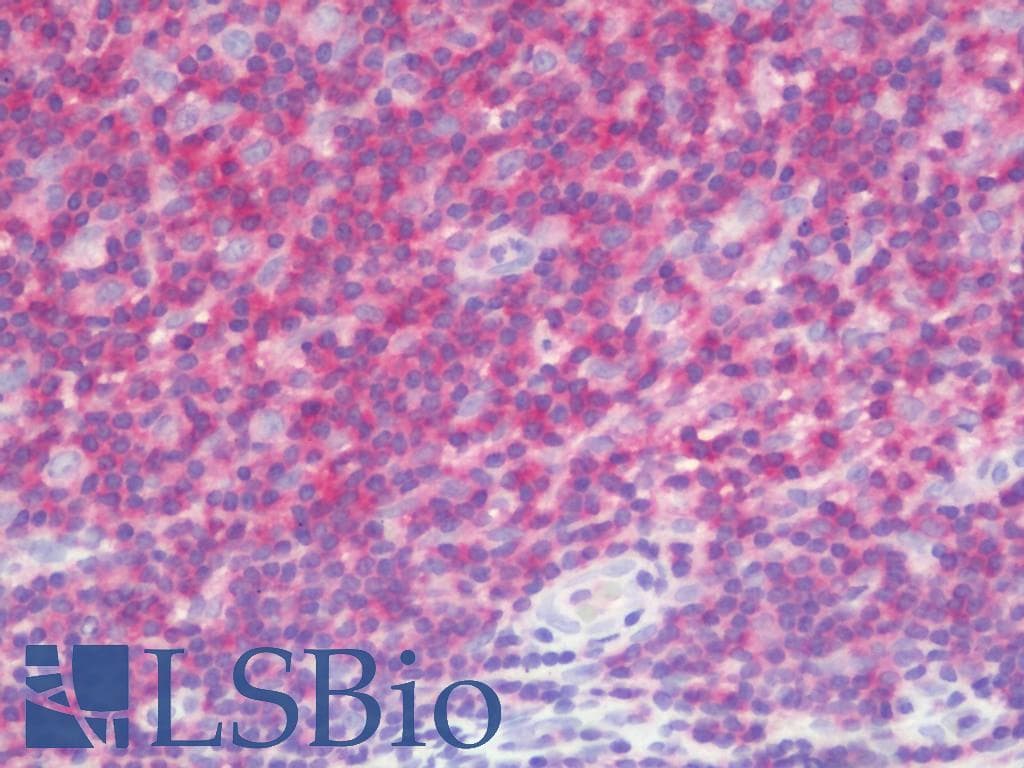 LRCH4 Antibody (clone 1F8, Carrier-free)