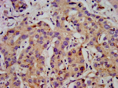 CACNB2 Antibody