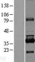 RPUSD1 Protein (Over-Expression Lysate Myc-DDK (Flag))