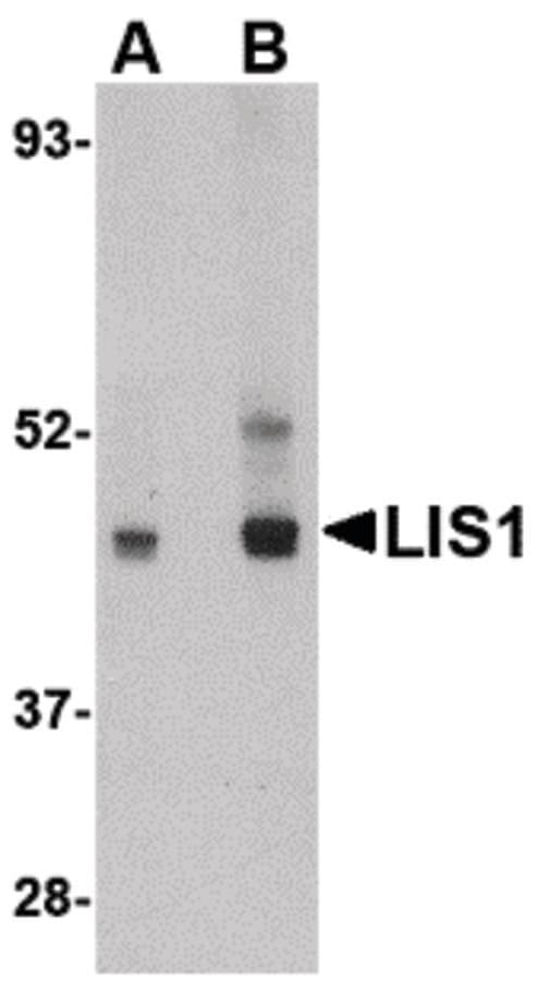 IHC-plus™ PAFAH1B1 / LIS1 Antibody