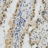 Polyclonal Rabbit anti-Human SUPT16H / FACTP140 Antibody (C-Terminus, IHC, WB)