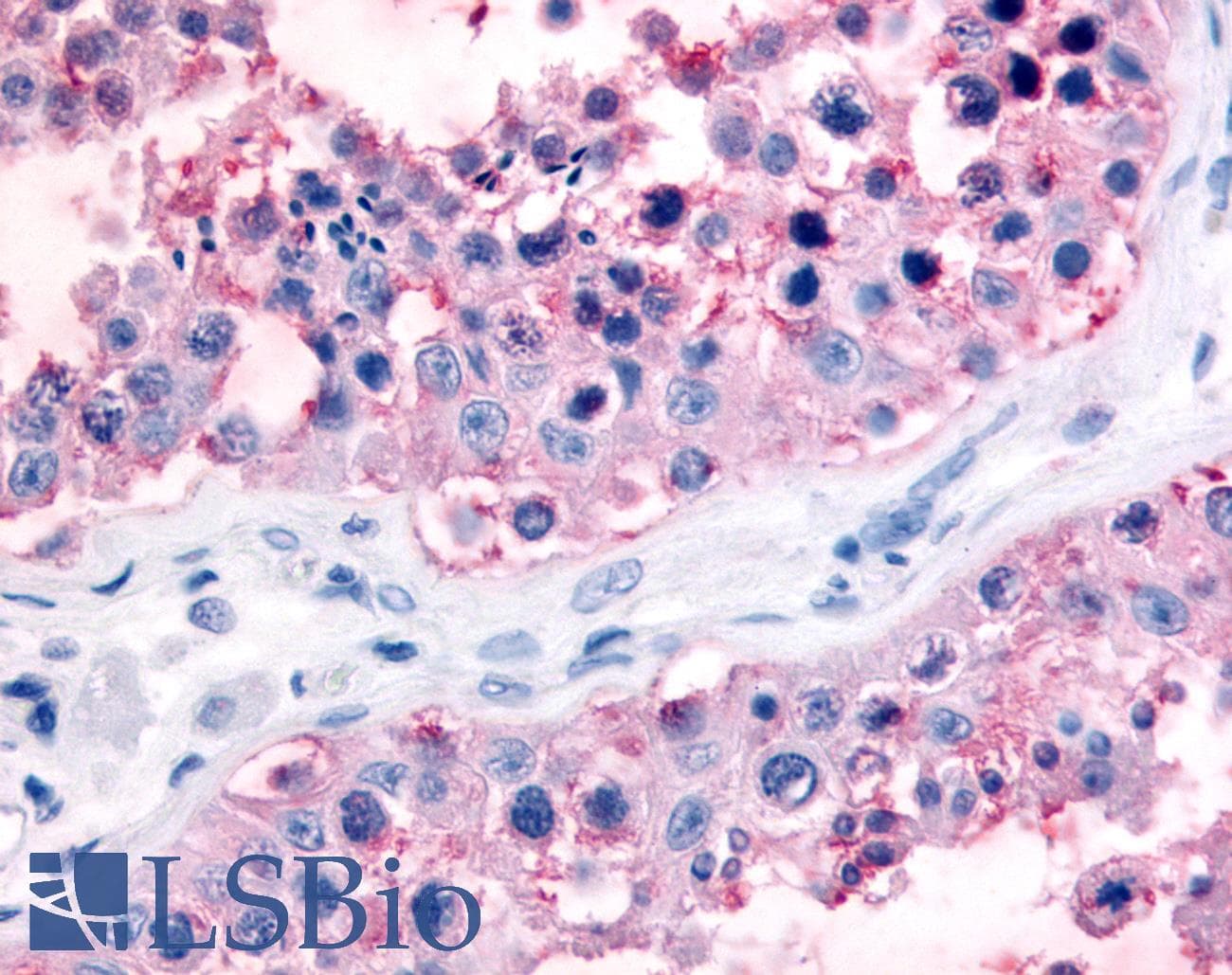 IHC-plus™ Polyclonal Rabbit anti-Human GJA1 / CX43 / Connexin 43 Antibody (C-Terminus, IHC)