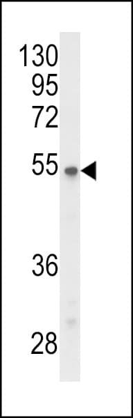 PPP2R3C Antibody (aa50-79)