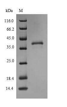 Human SLC31A1 / CTR1 Protein (Recombinant 6His-SUMO, N-terminus)