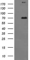 TP73 / p73 Antibody (clone OTI2H2)