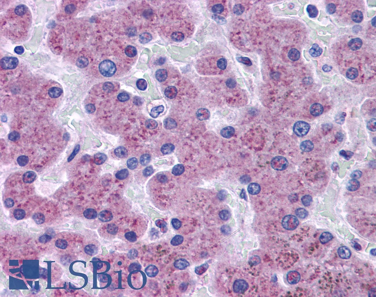 IHC-plus™ Polyclonal Rabbit anti-Human NAA35 Antibody (IHC, WB)