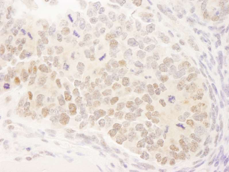 Polyclonal Rabbit anti-Human MAML3 / CAGH3 Antibody (aa1100-C-term, IHC)
