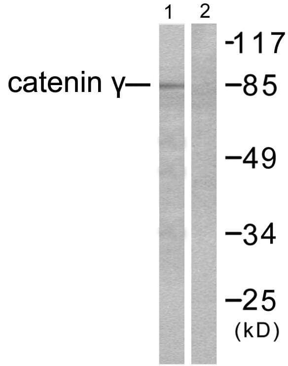 JUP/CTNNG/Junction Plakoglobin Antibody