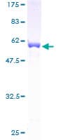 Human TPM4 Protein (Recombinant GST)