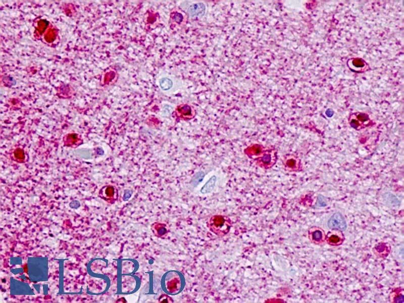 IHC-plus™ Polyclonal Rabbit anti-Human FZD3 / Frizzled 3 Antibody (aa481-530, IHC, IF, WB)