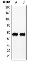 Polyclonal Rabbit anti-Human MYC / c-Myc Antibody (phospho-Thr58, IHC, WB)