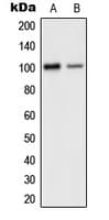 GRIA2 / GLUR2 Antibody (C-Terminus)