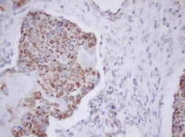 Monoclonal Mouse anti-Human IF3mt / MTIF3 Antibody (clone OTI1D6, IHC, WB)