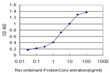 Monoclonal Mouse anti-Human PNMA1 / MA1 Antibody (clone 4G6, IHC, WB)