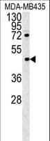 IFIX / PYHIN1 Antibody (aa26-55)