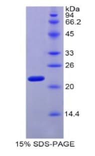 Mouse MYL4 Protein (Recombinant His)
