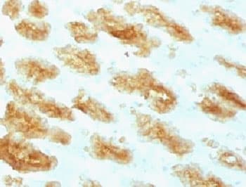 Acidic Cytokeratin Antibody (clone ACCK1-1)