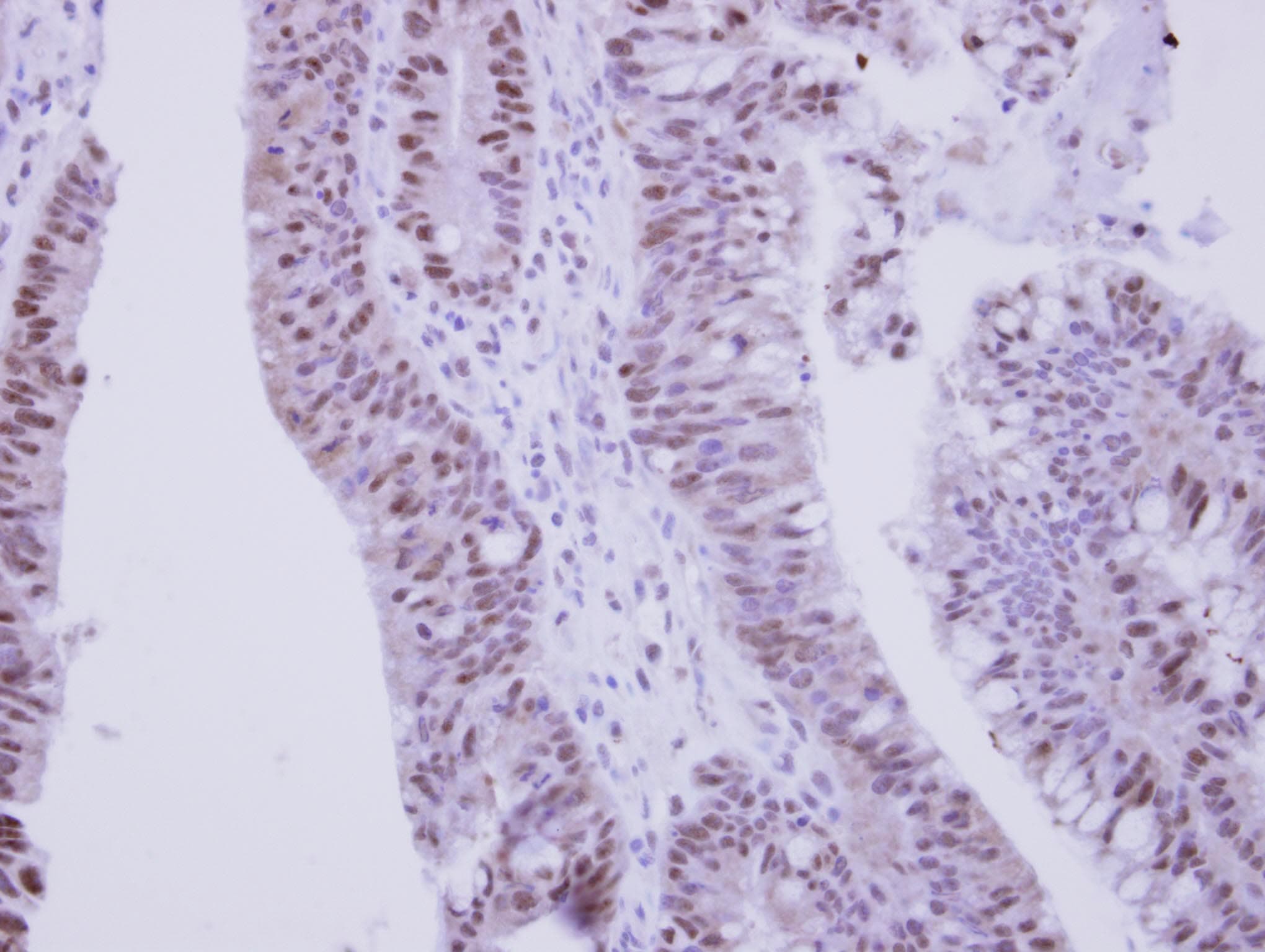 ZNF329 Antibody