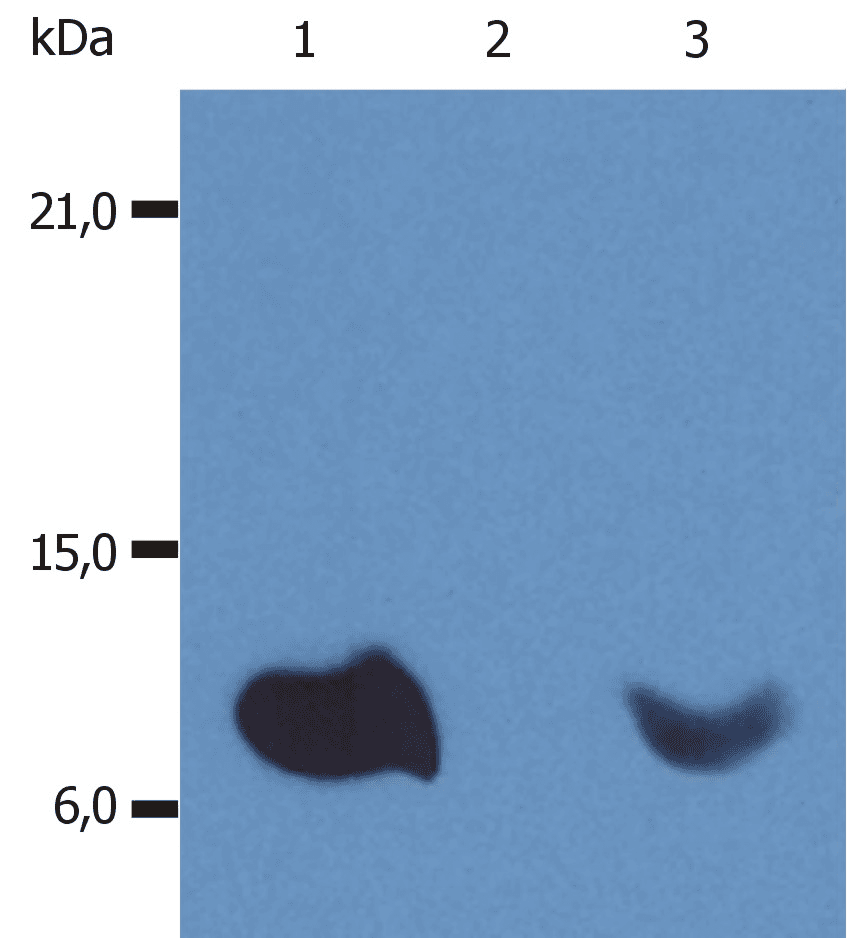 PathPlus™ B2M / Beta 2 Microglobulin Antibody (clone B2M-01)
