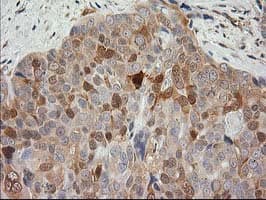 MAPRE2 / EB2 Antibody (clone OTI7A2)