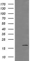 CTAG1B / NY-ESO-1 Antibody (clone OTI4D8)